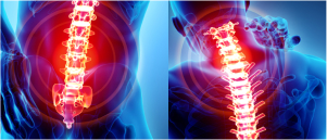 Brain Tumor Surgery