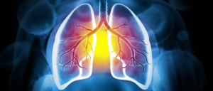 Chronic Bronchitis