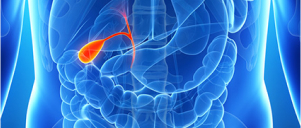  Preventive Care for Gallstones
