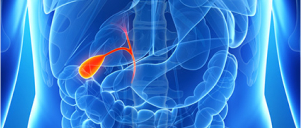 Surgery for Gallstones