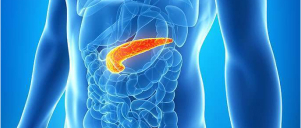 Pancreatitis