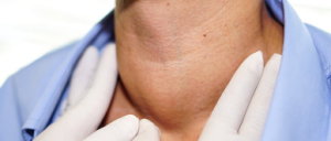 Hypothyroidism