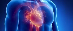 CABG