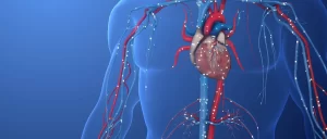 Endovenous Laser Therapy (EVLT)
